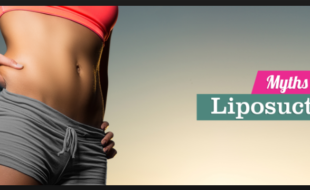 liposuction myths facts