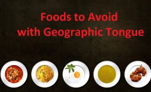 foods to avoid with geographic tongue