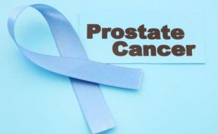 Prostate Cancer signs and symptoms